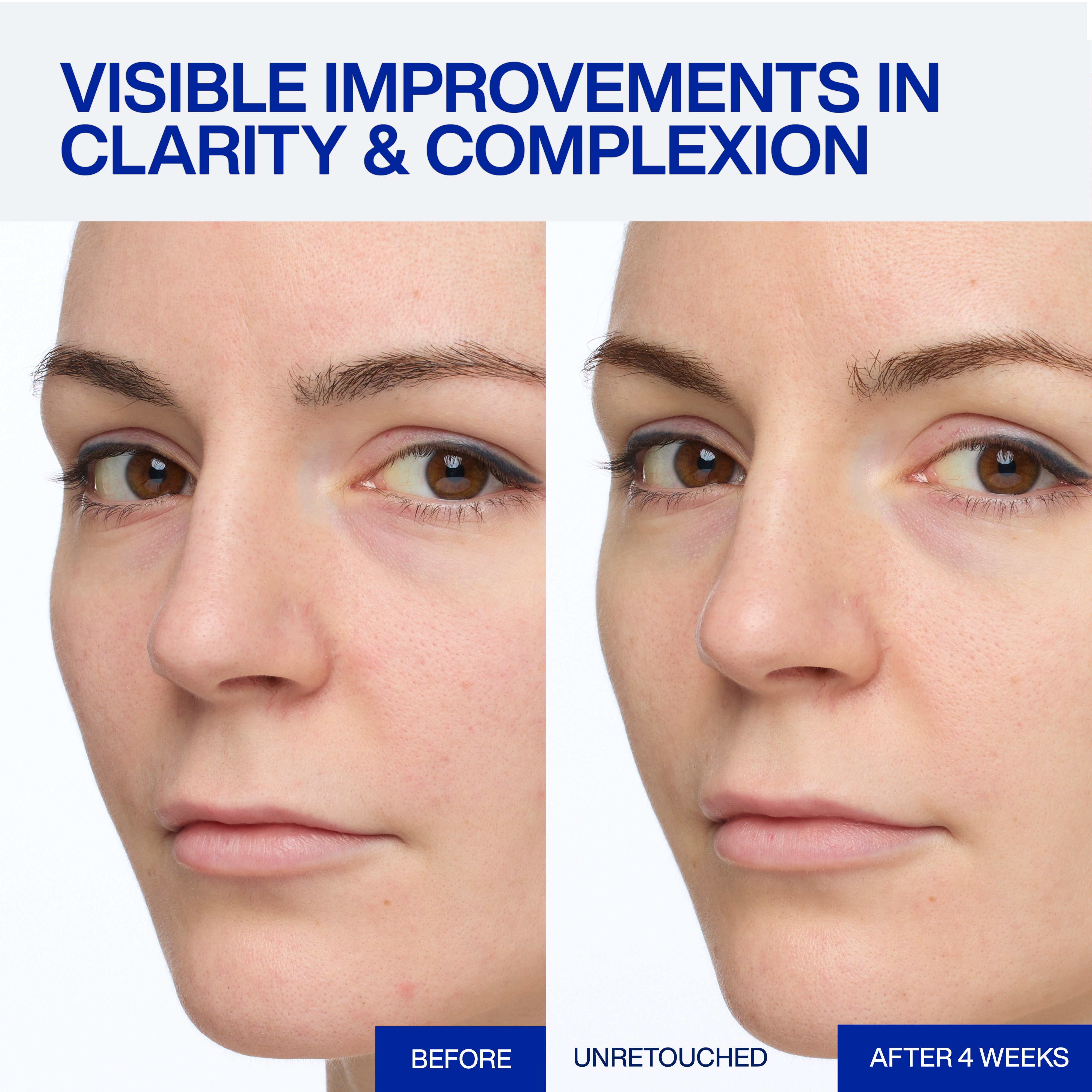 EXPERT VITAMIN C 25% ANTIOXIDANT SERUM