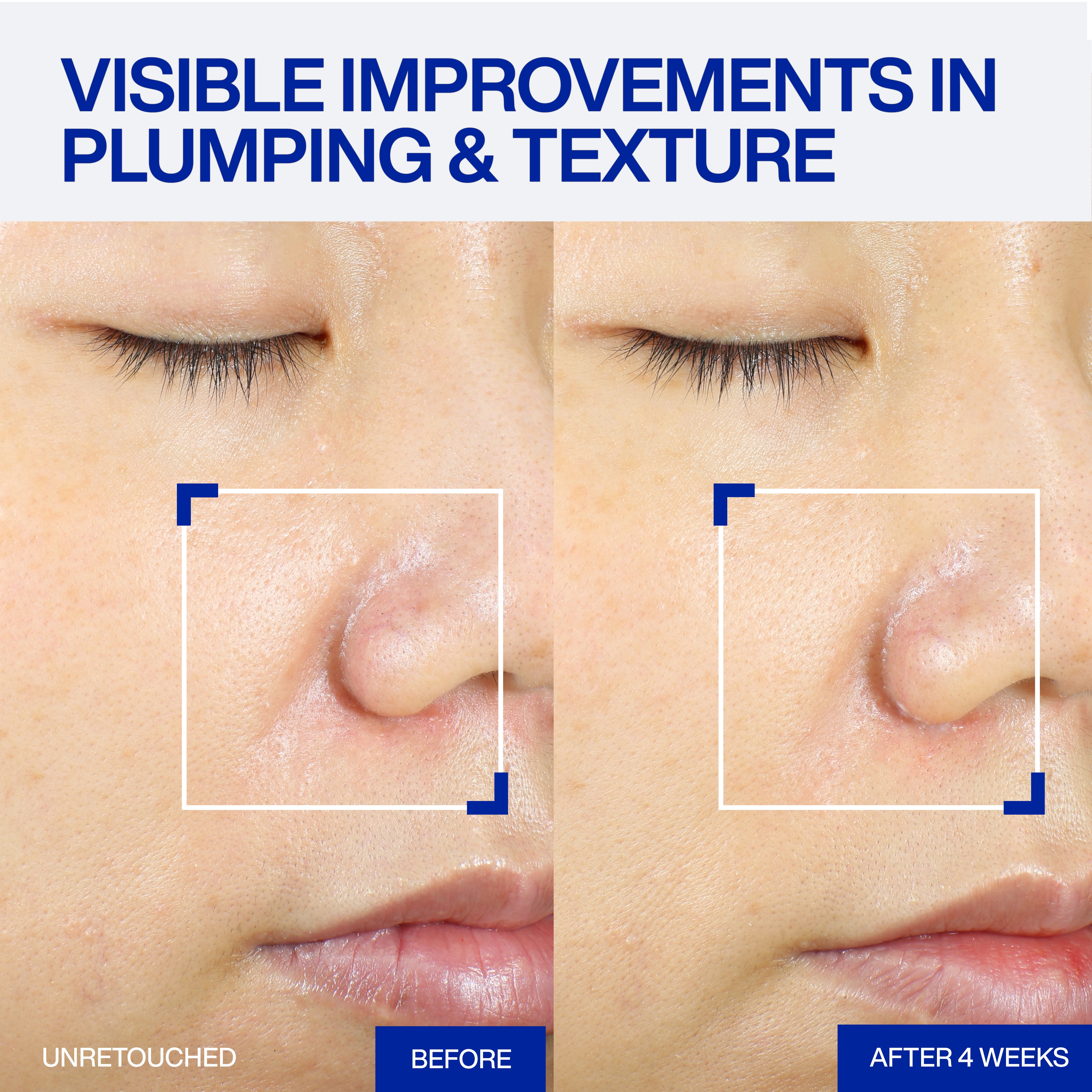 XMD STEM III CLINICAL RECOVERY SERUM