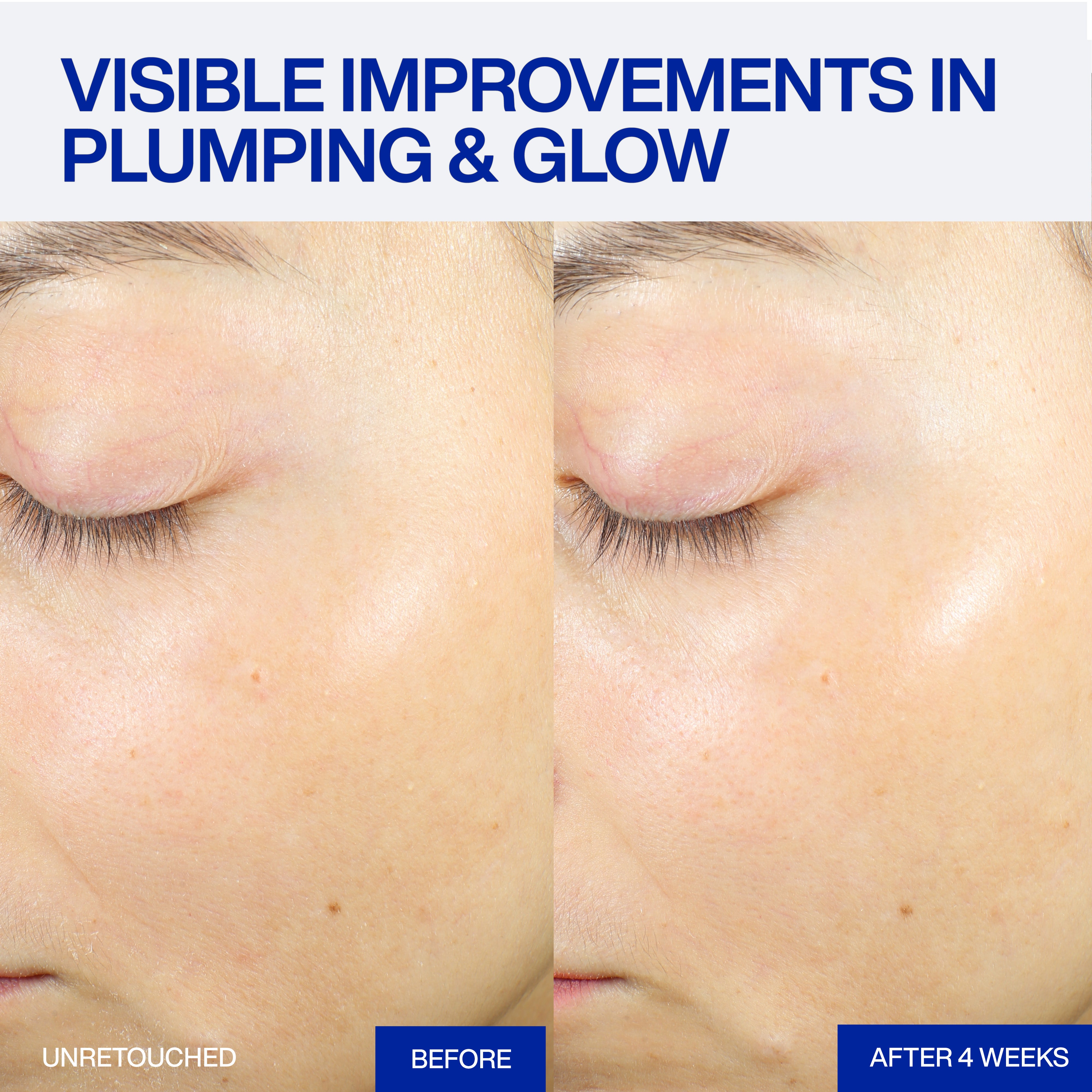 XMD STEM III CLINICAL RECOVERY SERUM